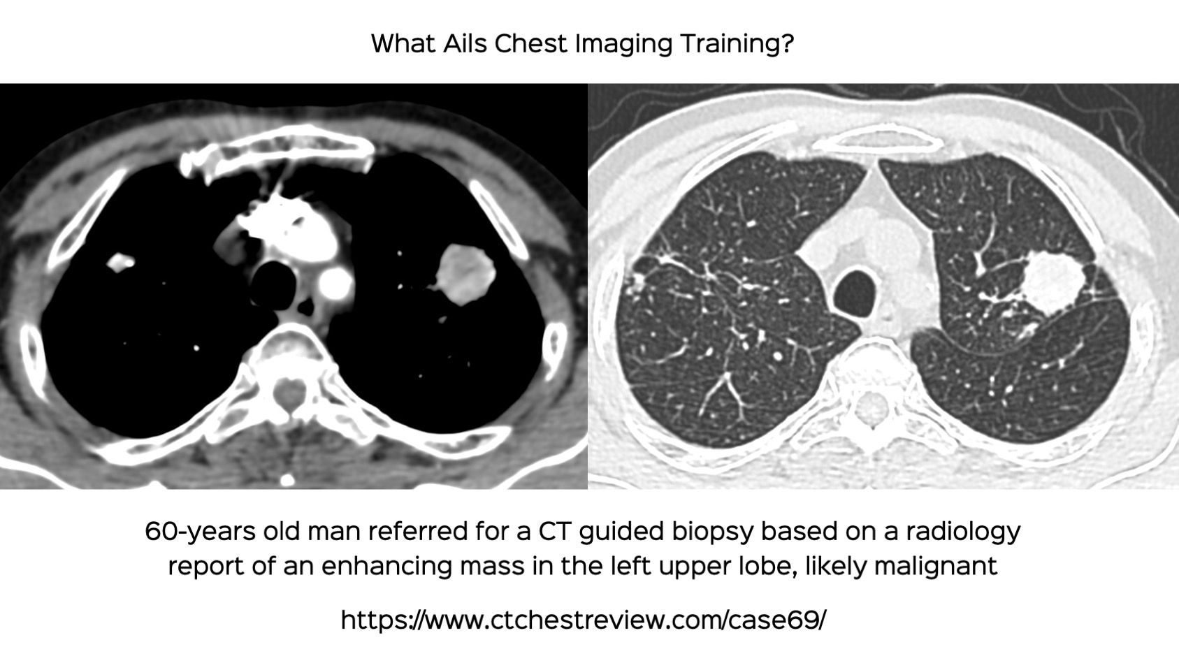 case-69-what-ails-chest-imaging-training