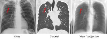 Scan Protocol - Ct Chest Review