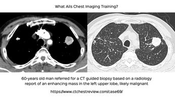 CT Chest Review